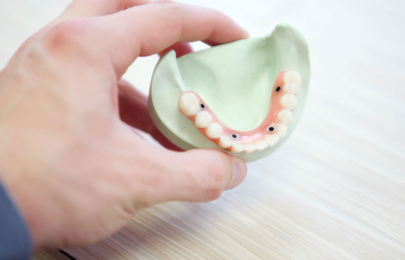 Warum sollten Sie sich für Zahnimplantate entscheiden?